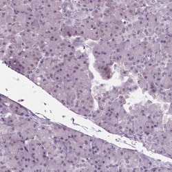 IGF2BP1 Antibody, Novus Biologicals 0.1mL; Unlabeled:Antibodies, Polyclonal